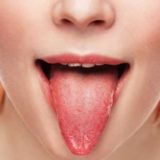 【舌苔はぜったい阻止！】口臭の元凶となる白い舌の原因と対策