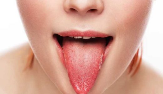 【舌苔はぜったい阻止！】口臭の元凶となる白い舌の原因と対策